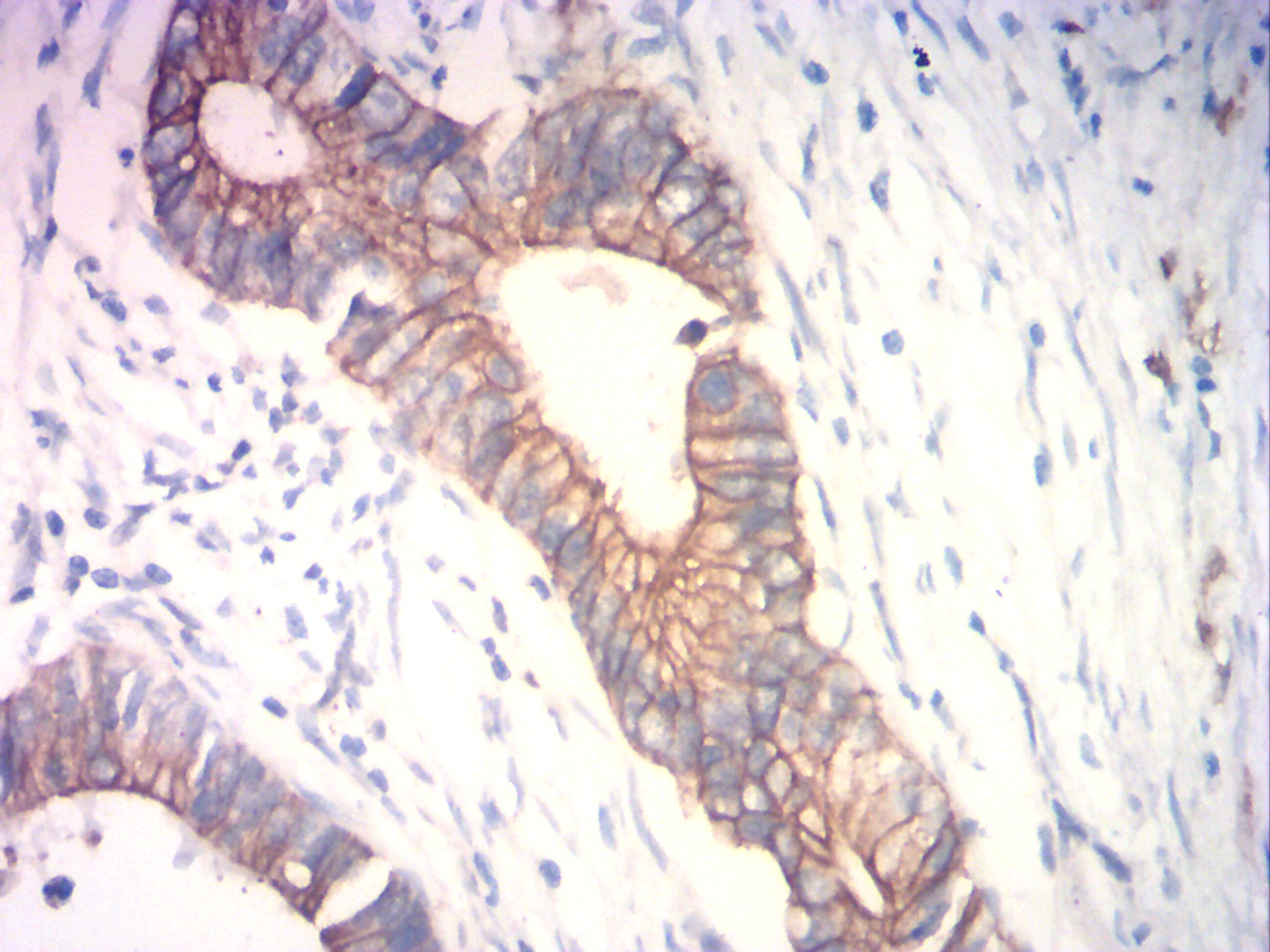 IHC